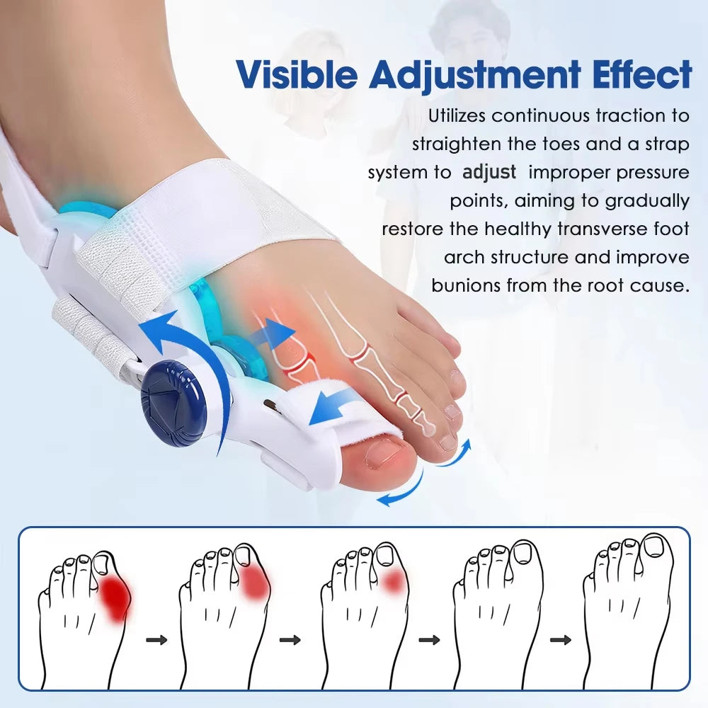 Adjustable Bunion Toe Splint with Gel Pad – 1 Piece